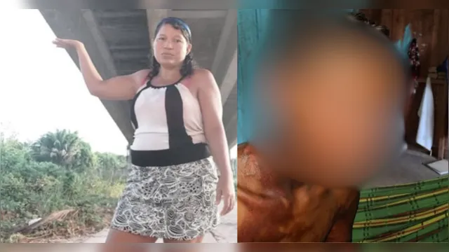 Vídeo: Madrasta é presa após queimar enteado com água quente