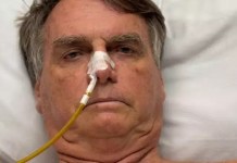 Médico afirma que Bolsonaro sofreu traumatismo craniano leve após queda em cela da PF