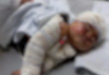 Bebê fica gravemente ferido após colisão causada por motorista embriagado na PA-150