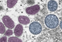 Caso de Mpox é confirmado em Porto Alegre