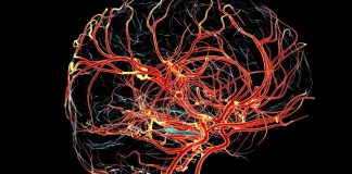 Médicas explicam importância da alimentação na recuperação do AVC