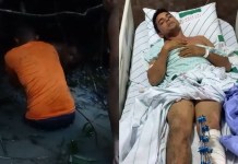 Após grave acidente em Moju, jovem relata momentos de sobrevivência e agradece apoio recebido