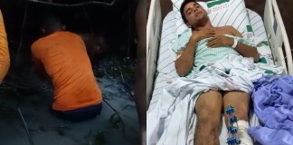 Após grave acidente em Moju, jovem relata momentos de sobrevivência e agradece apoio recebido