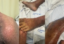 Hapvida descumpre decisão judicial por mais de 50 dias e criança é internada em estado grave