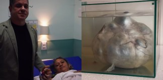 Dr. Alessandro Lobato realiza feito histórico ao retirar cisto de quase 10 kg em Igarapé-Miri
